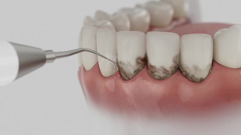 Trusted Dental Crowns And Bridges service in Cockrell Hill, TX - Dentist Open Now